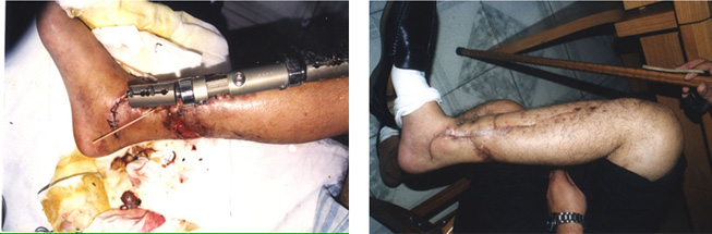 利来最给利的老牌(中国区)_利国国际w66