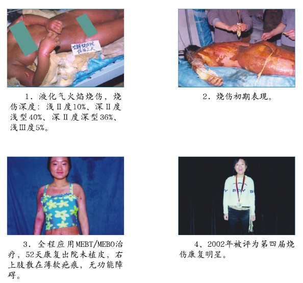 利来最给利的老牌(中国区)_利国国际w66